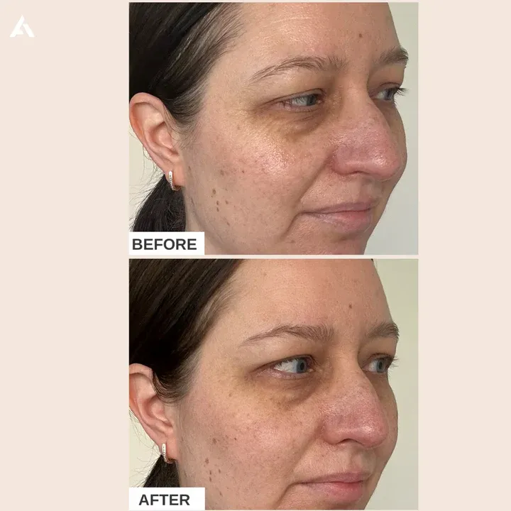 AlphaHfirmingCollagenCream_result_2.webp