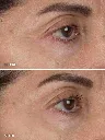 Alpha-heyecream-model_1080x.webp