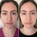 8WeekTrialVitaminBSerum_RozanaTimis_1080x.webp