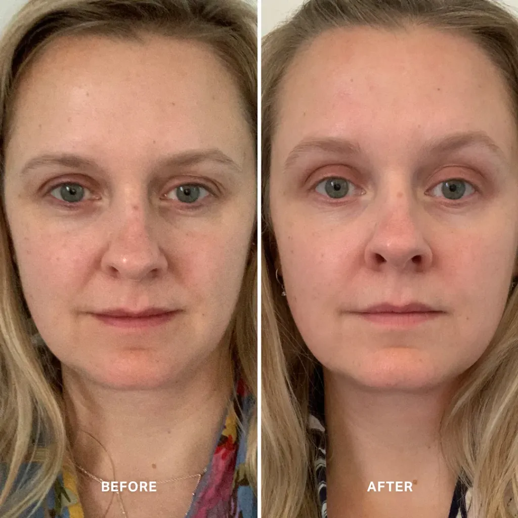 4WeekTrialVitaminASerum_JenWoodward_1080x.webp