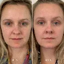 4WeekTrialVitaminASerum_JenWoodward_1080x.webp