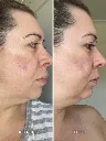 Alpha-H-A-Serum-BA-1_1080x.webp