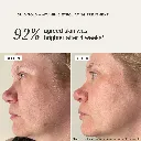 AlphaH-LGVC100-2_1080x.webp