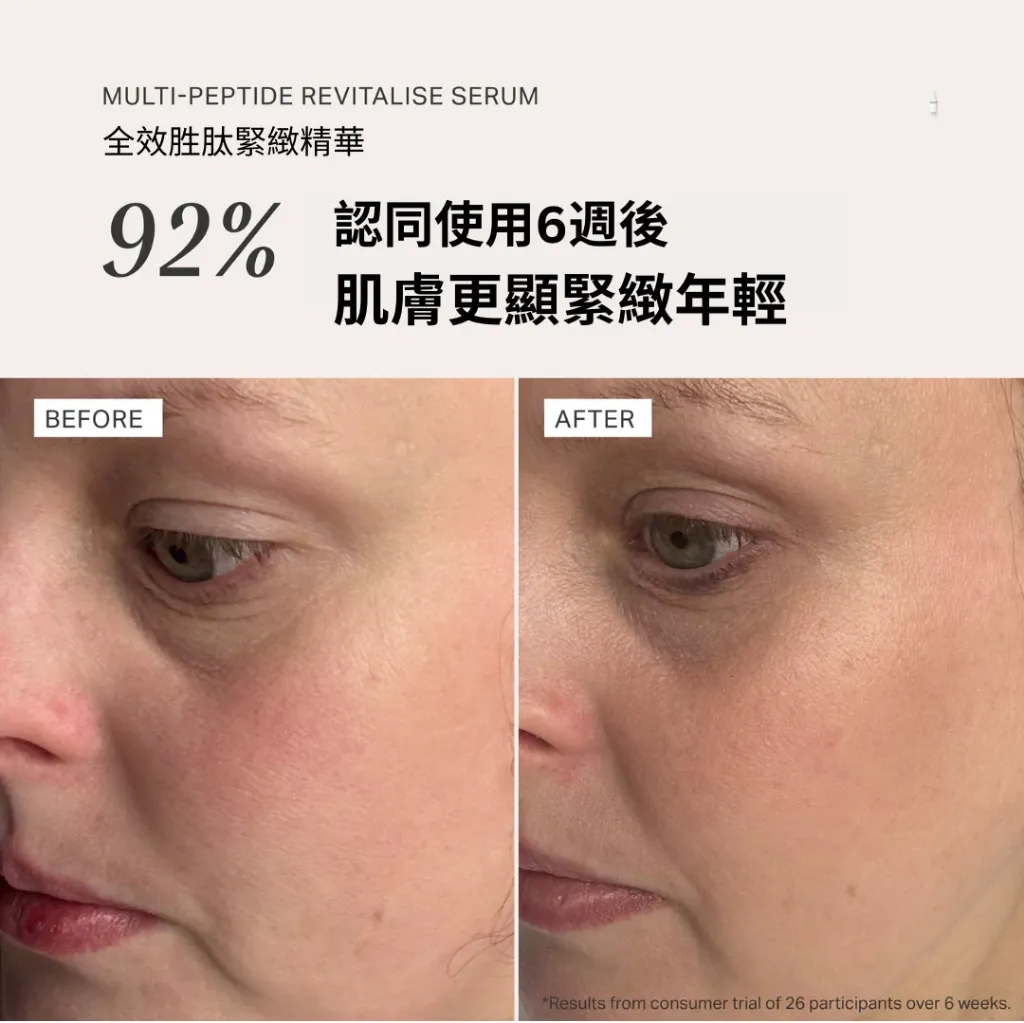 4_4ac86fdd-6e71-4dcc-a48f-b706e8fc1029_1080x.webp
